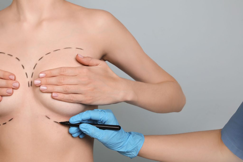 Comparaison de prix d’une chirurgie esthétique refaire ses seins
